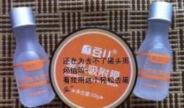 麻豆儿黑头,揭秘黑头形成与护理之道